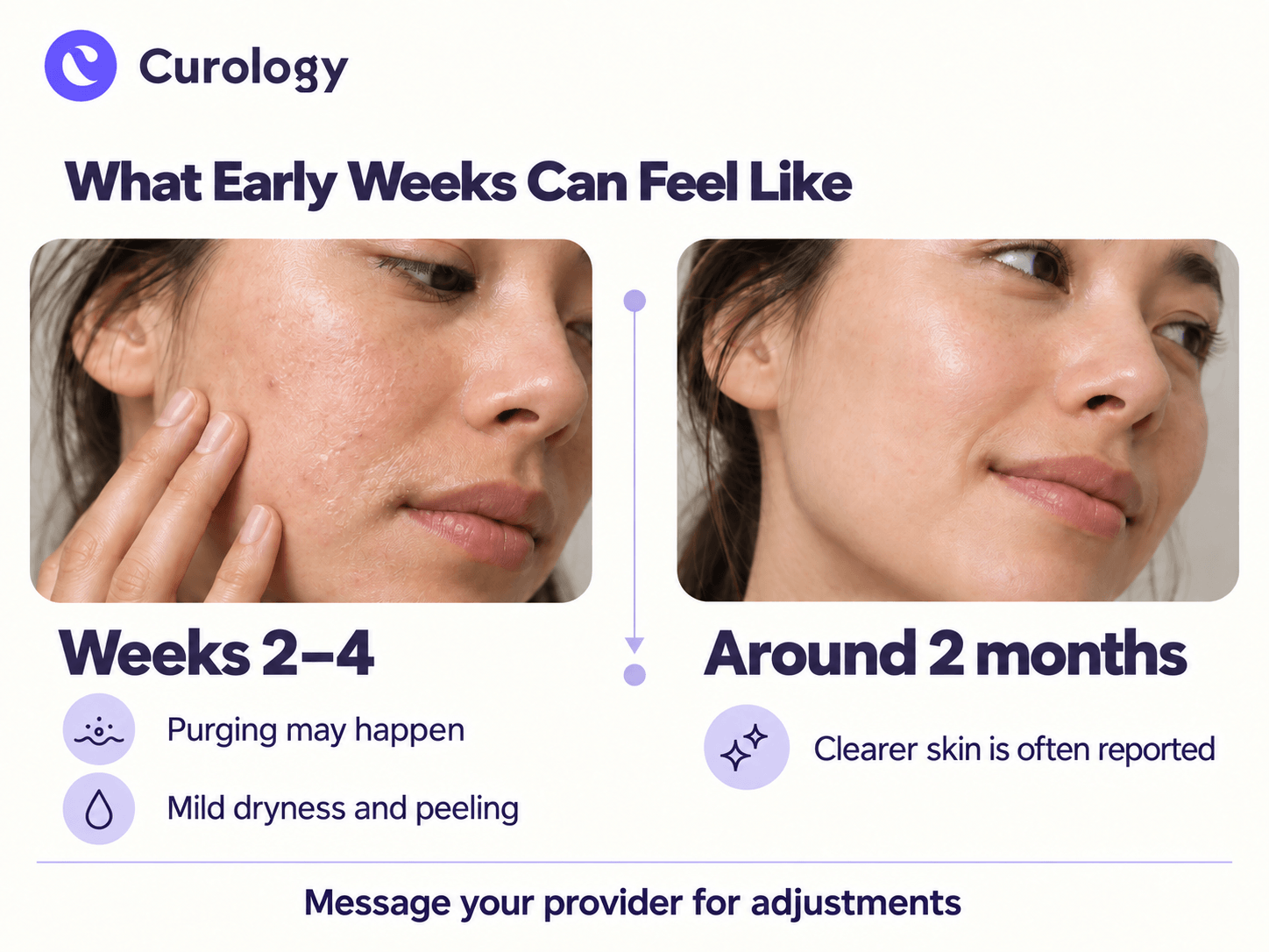 Curology-img-3